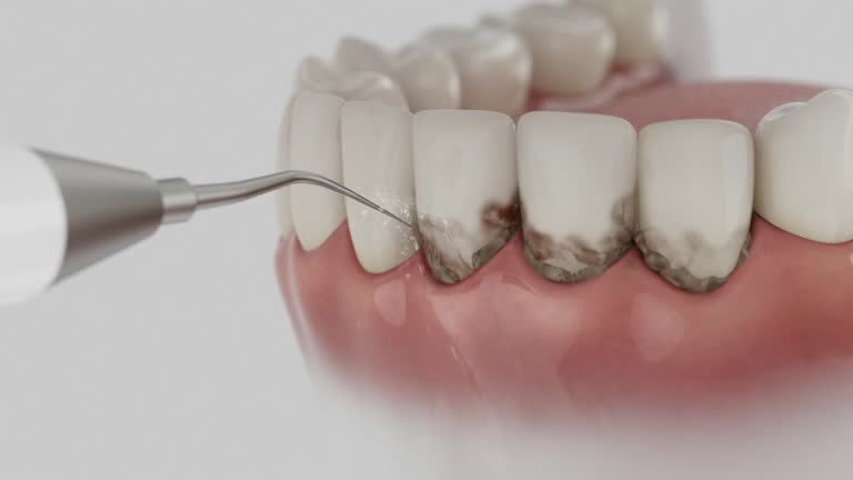 Reliable Dental Implants contractor in Kalida, OH by Smile Center Dentistry